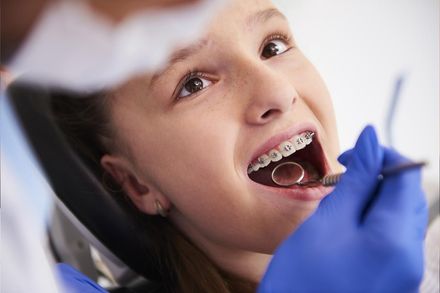 Consultation orthodontique