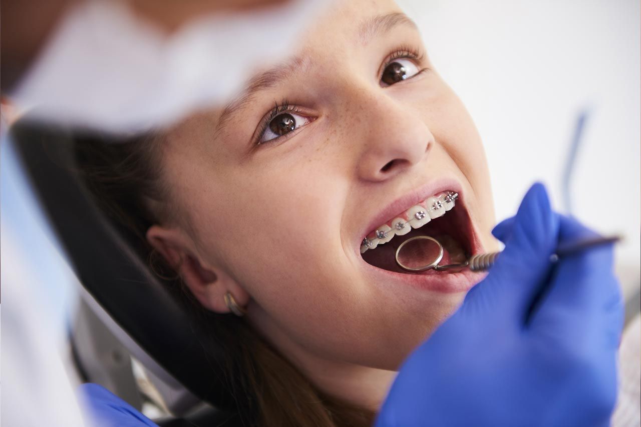 Orthodontie — photographie source